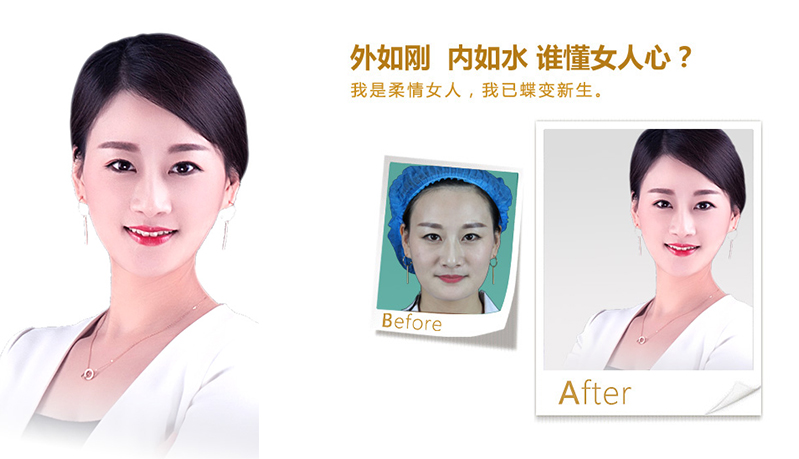 济宁V脸、线雕隆鼻